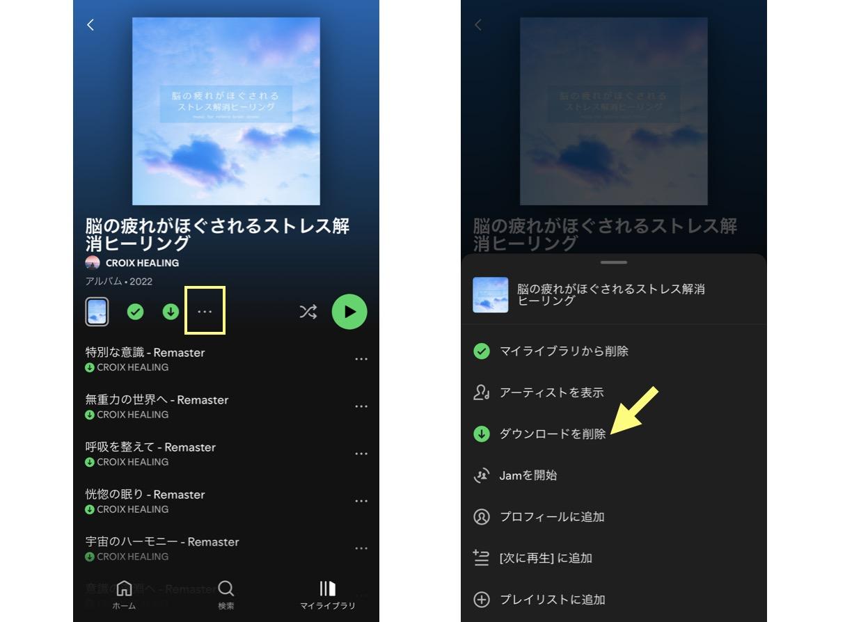 spotify ダウンロード 保存先 iphone